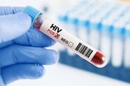 hiv tests visas immigration