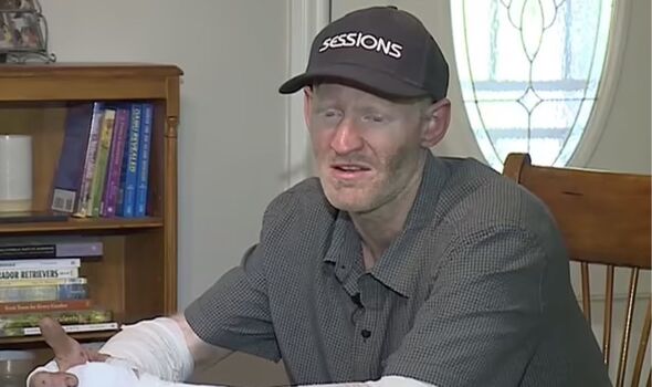 Mr McClish sitting at a table with bandaged arms