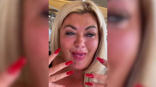 Gemma Collins nearly died after getting stung by wasp on holiday