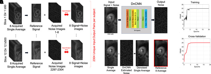 (A) The data set of 23 040 input and output images used for training and testing the proposed denoising convolutional neural network (DnCNN) comprises 10 reference eight-average diffusion-weighted image (DWI) data sets (12 sections, 12 directions [Dir], b = 50, and b = 500) and 2304 complex noise input-output pairs. Complex noise images were acquired using the same diffusion-tensor MRI (DT-MRI) sequence but with radiofrequency excitation turned off. (B) Architecture of the proposed residual deep learning DnCNN consisting of a series of 56 layers of convolution (Conv), batch normalization (Batch Norm), and rectified linear unit (ReLU) operations. Stride and padding parameters were set to [1 1] and [1 1 1 1], respectively. The purpose of the DnCNN is to estimate the residual error (or unwanted noise) from a noisy signal by employing convolutional layers and subsequently using Batch Norm for fast and stable training that may arise from ill-poised initialization and changes in distributions of internal nonlinearity. The resulting output residual image in the denoising context is the “noise image,” which can be removed subsequently by simple subtraction. Thus, for this application of the DnCNN to in vivo cardiac DT-MRI, the input of the DnCNN is acquired single-average (signal + noise) DWIs, and the output results in estimated noise images. (C) Representative example of showing a single average raw DWI b = 50 image being denoised with a comparison with a reference eight-average DWI. First, the input single-average data are fed into the DnCNN to estimate the output residual noise. This output noise is then subtracted from the input single-average image to derive the desired denoised single-average image. Noise images in this figure are windowed to better visualize the underlying spatial pattern (20% increased brightness and 20% decreased contrast). (D) Cross-validation plot during training of the DnCNN-54 using 2304 test denoised DWI data sets (ie, not used for training). The peak signal-to-noise ratio leveled off at about 10 epochs.