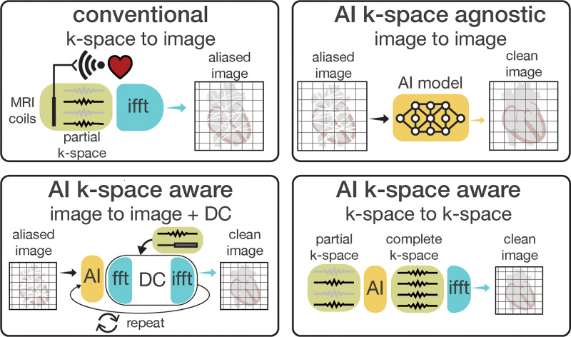 Diagram of accelerated cardiac MRI reconstruction techniques. Accelerated imaging shortens scan time by collecting only partial k-space data instead of a complete set. The traditional reconstruction uses inverse fast Fourier transform (ifft) for k-space-to-image transformation, causing aliasing artifacts in accelerated imaging. K-space-agnostic artificial intelligence (AI) methods transform aliased images (input) into clean, high-quality images (output) without detailed knowledge of the acquisition process. Conversely, k-space-aware AI methods use information of the acquisition process as prior knowledge, integrating image-to-image models with alternating k-space data consistency (DC) steps to better handle incomplete k-space data. Alternatively, AI models can convert partial k-space inputs into a complete set, aiding in generating cleaner, higher-quality images. fft = fast Fourier transform.