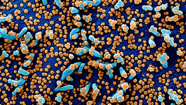 Micrografia eletrônica digitalmente colorida de uma célula VERO E6 (azul) bastante infectada com partículas do vírus SARS-COV-2 (laranja) - Sputnik Brasil