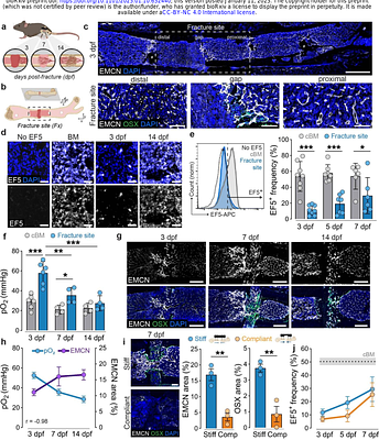 Local erythropoiesis directs oxygen availability in bone fracture repair