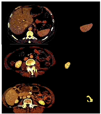 A survey on Organoid Image Analysis Platforms