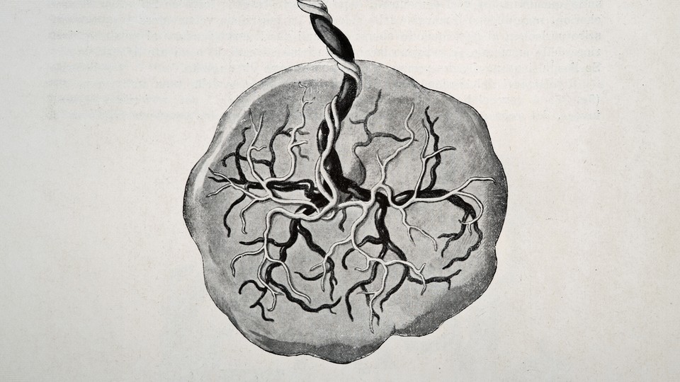 A 1905 medical drawing from Trattato Completo di Ostetricia (by Esnesto Bumm and Cesare Merletti) illustrates the human placenta.