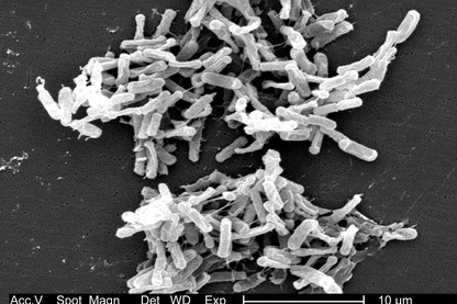 A microscopic shot of the bacteria that cause C. diff