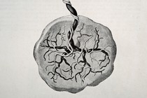A 1905 medical drawing from Trattato Completo di Ostetricia (by Esnesto Bumm and Cesare Merletti) illustrates the human placenta.
