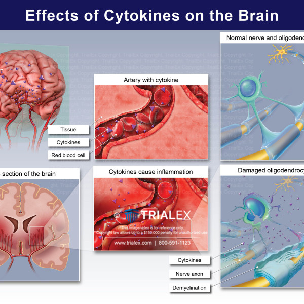 Effects of Cytokines on the Brain