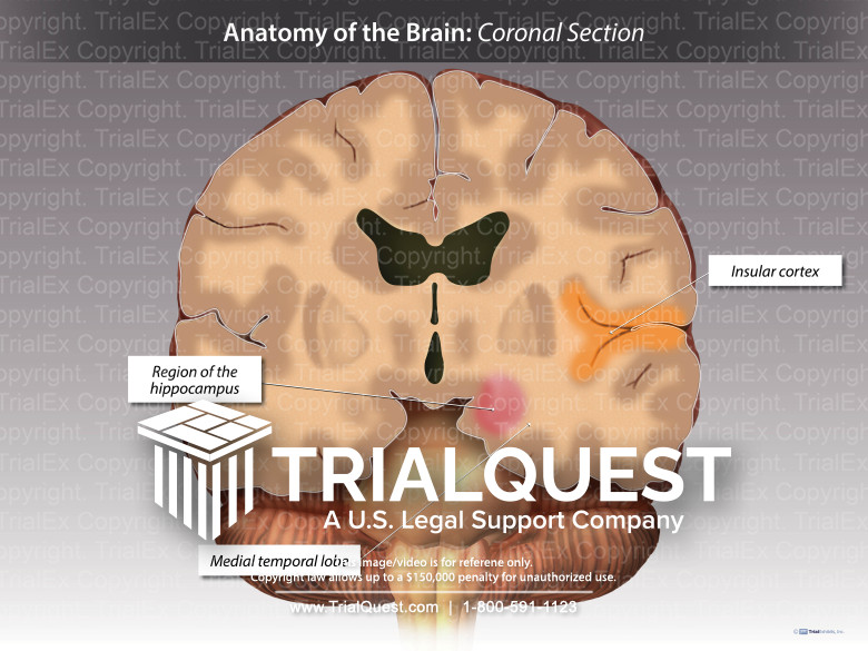 Anatomy of the Brain: Coronal Section