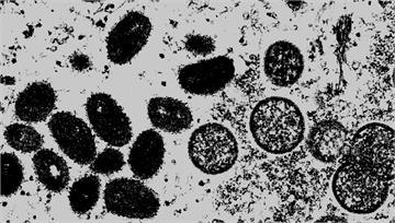 M痘變異株「可飛沫傳染」入侵亞洲！　泰國現首例