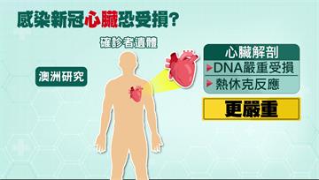 新冠染疫者遺體「驚人發現」 醫師：病毒「攻心為上...