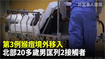 第3例猴痘境外移入  北部20多歲男「匡列2接觸...