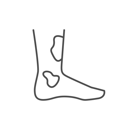 Foot eczema line outline icon vector image