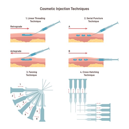 Cosmetic injection technique set filler vector image