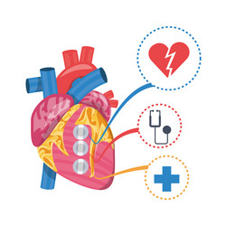 heart condition to infarction prevention vector image