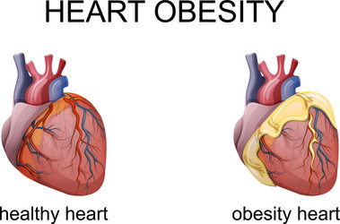 obesity heart vector image