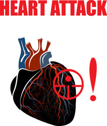 heart myocardial infarction vector image