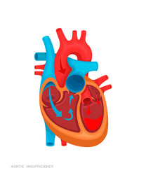 heart defect vector image