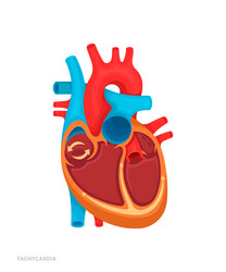 heart defect vector image