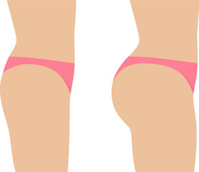 female ass before and after plastic surgery vector image