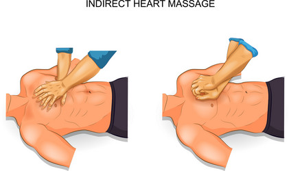 Indirect heart massage options vector