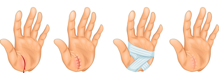 cut on hand vector image