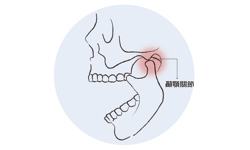 顳顎關節障礙,顳顎關節,下顎痛