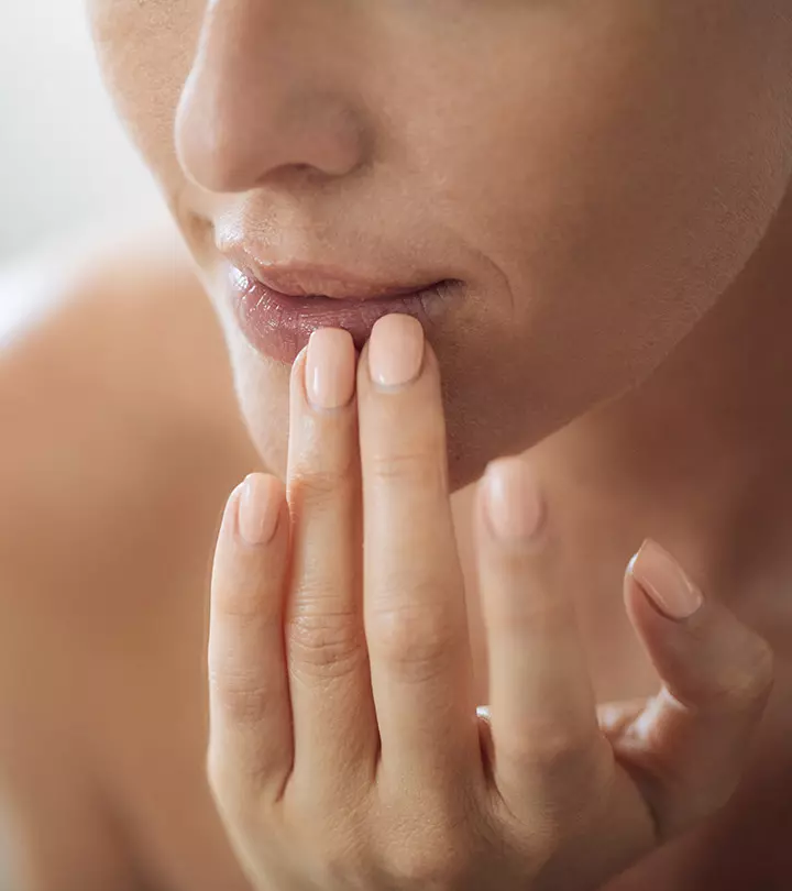 Woman With Hyperpigmentation Around Mouth