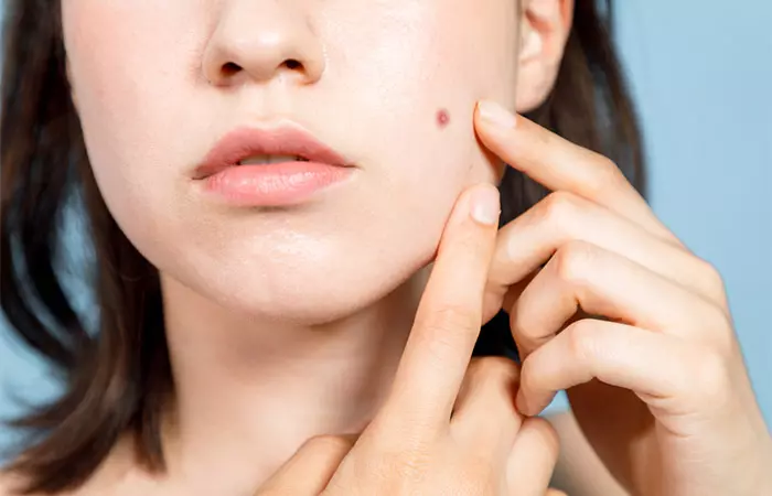 Woman checking her mole