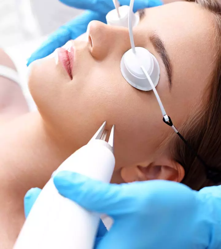 Laser Treatment For Acne Scars: Effect, Types, & How It Works