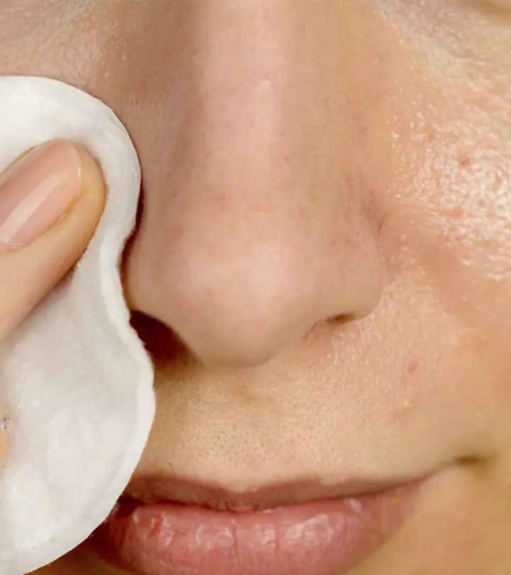 Women Applying Hydrogen Peroxide For Blackhead Removal