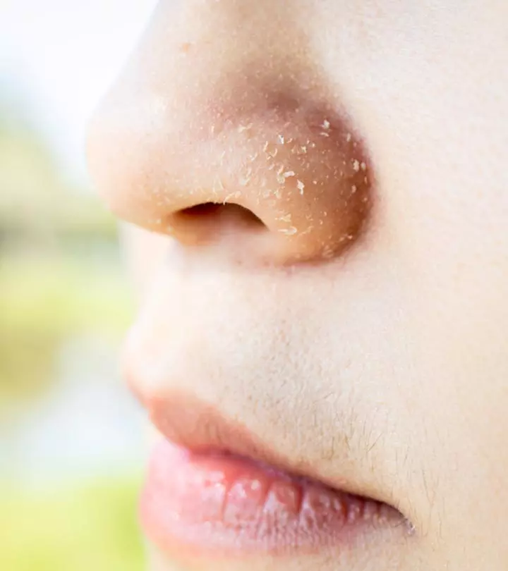 A woman with dry skin around mouth