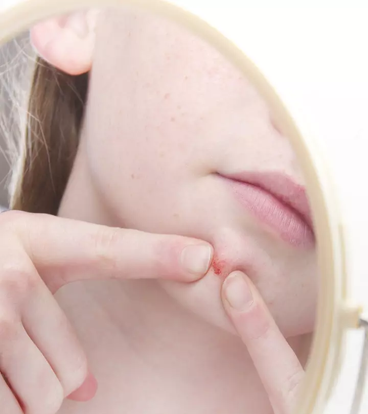 Dermatillomania: Symptoms, Causes, And Treatment