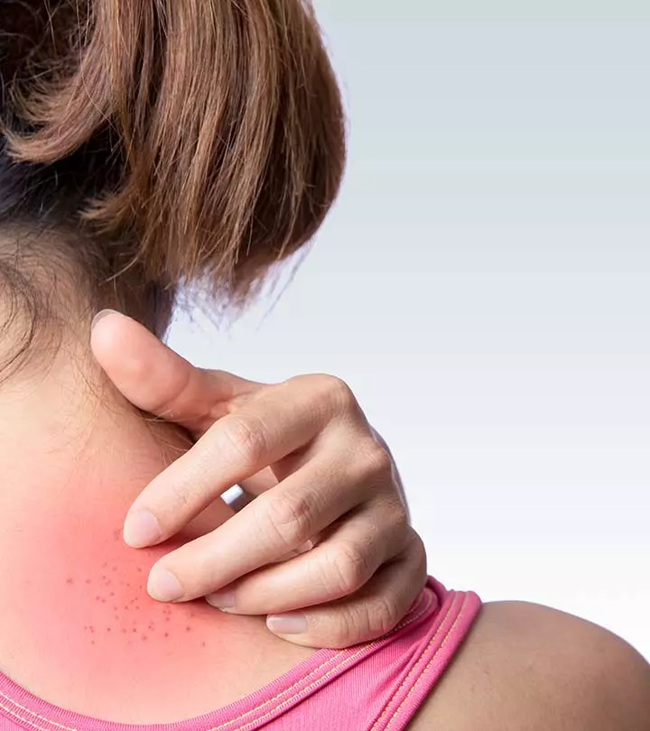 Not all rashes are allergies—taking note of the symptoms can help you find the right remedy.