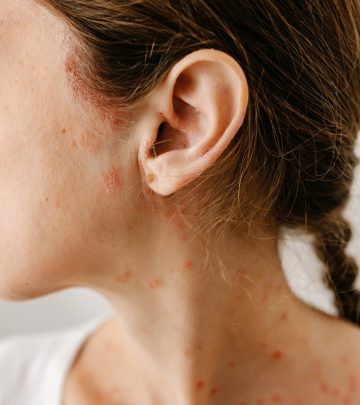 Red Spots On The Skin: Causes, Treatments & How To Get Rid Of Them