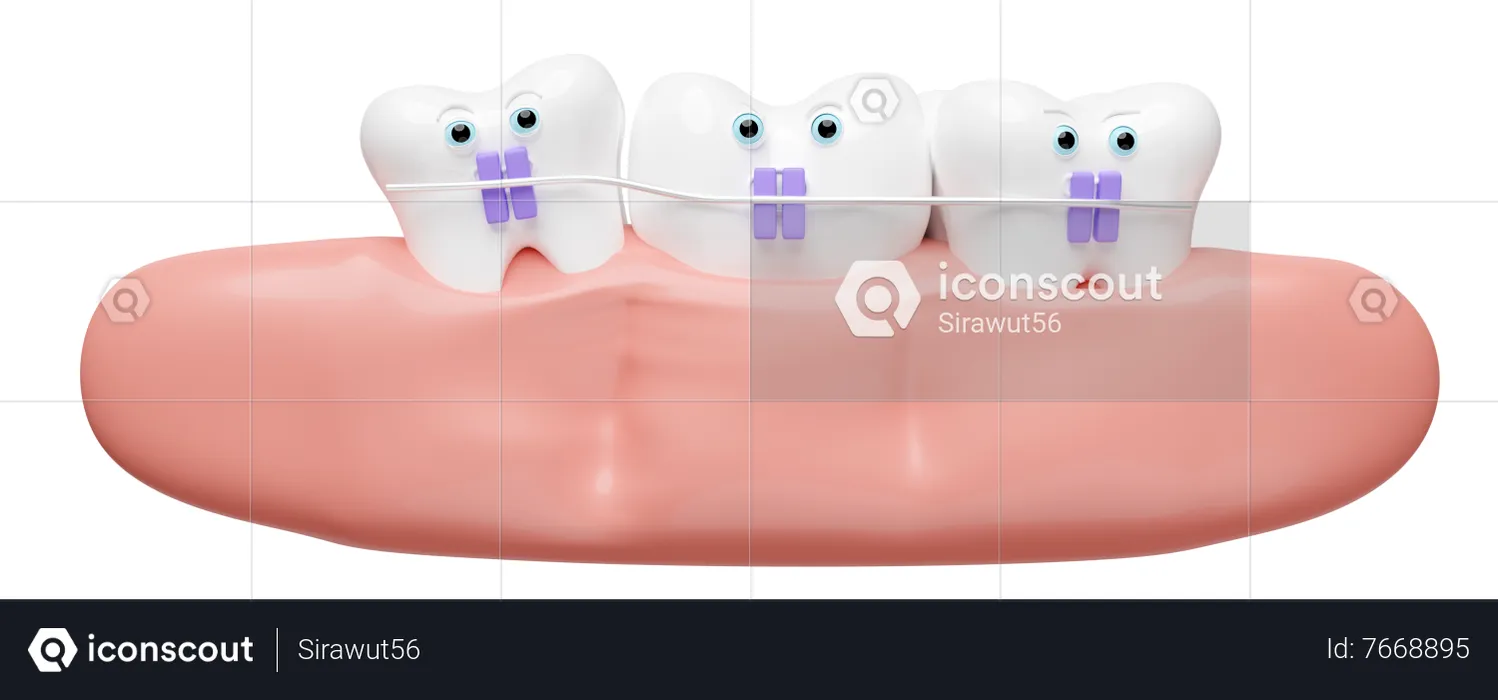 Ortodoncia  3D Illustration