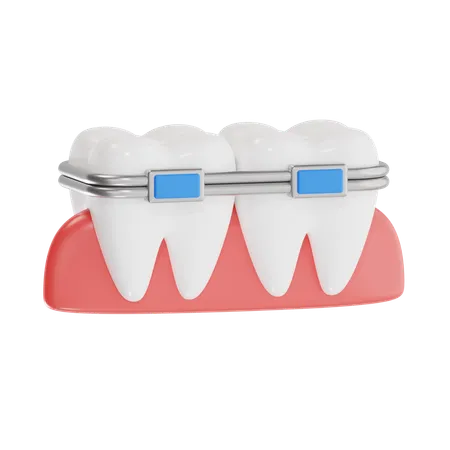 Brackets dentales  3D Icon