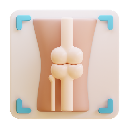 Arthritis Xray  3D Icon