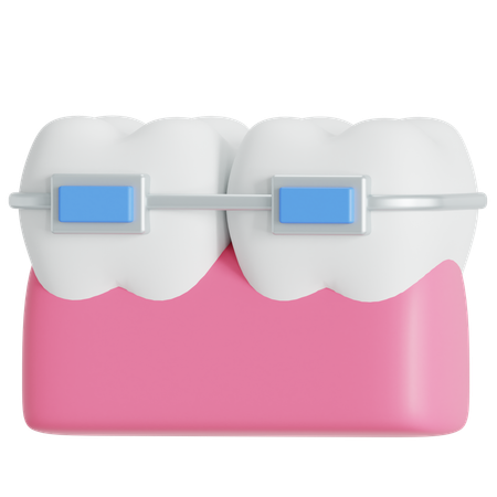 Braces  3D Icon