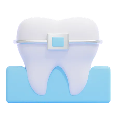 Braces  3D Icon