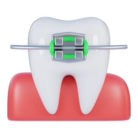 Braces  3D Icon