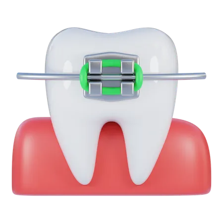 Braces  3D Icon