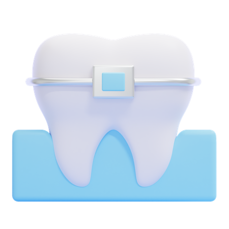 Braces  3D Icon