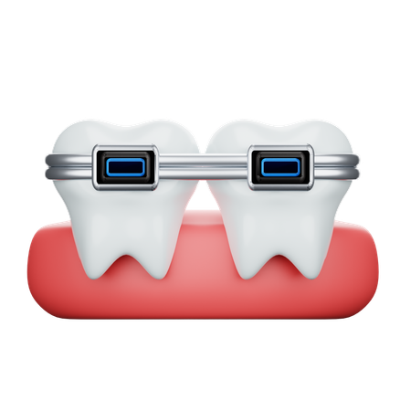 Brackets dentales  3D Icon