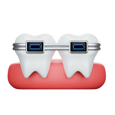 Brackets dentales  3D Icon