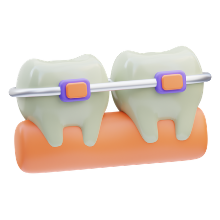 Brackets dentales  3D Icon