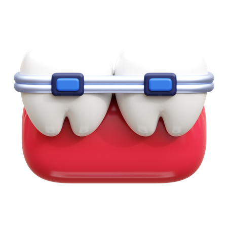 Brackets dentales  3D Icon