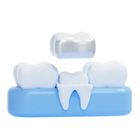 Dental Crown  3D Icon