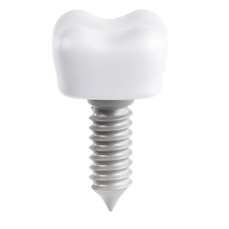 Implante dental  3D Icon