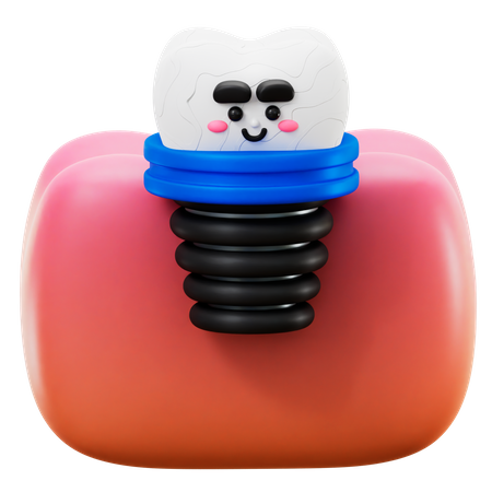 Implante dental  3D Icon